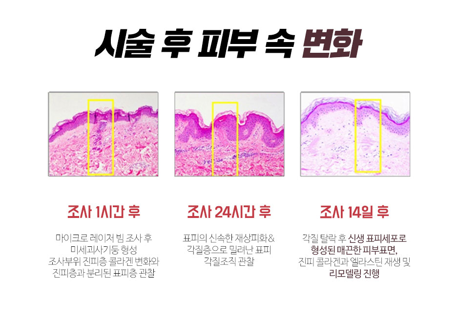 제니바_프락셀_10.jpg