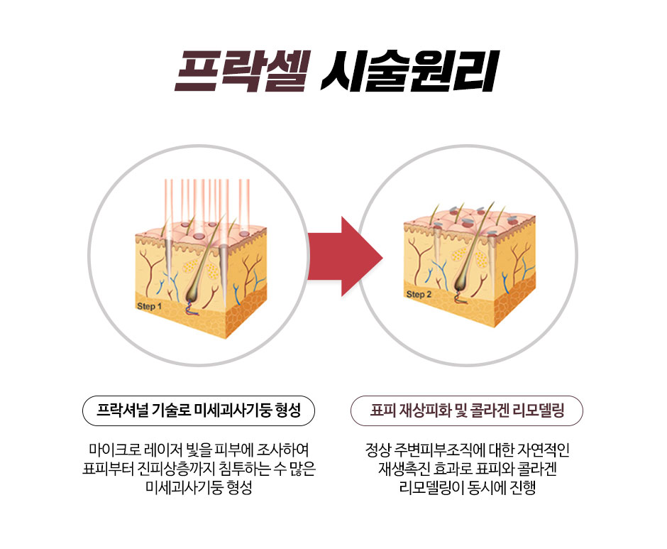 제니바_프락셀_09.jpg