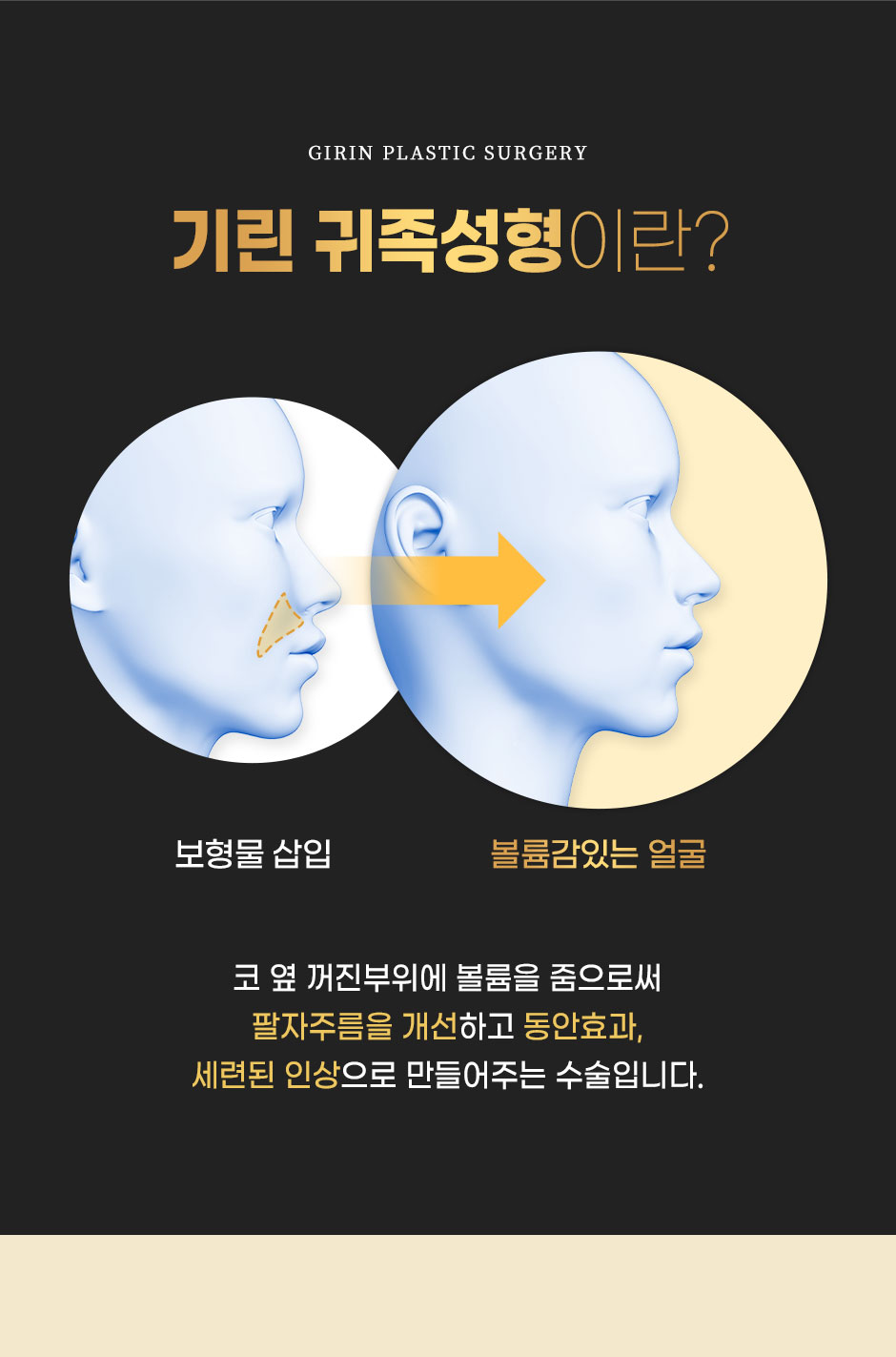 보형물윤곽성형_미인하이_03.jpg