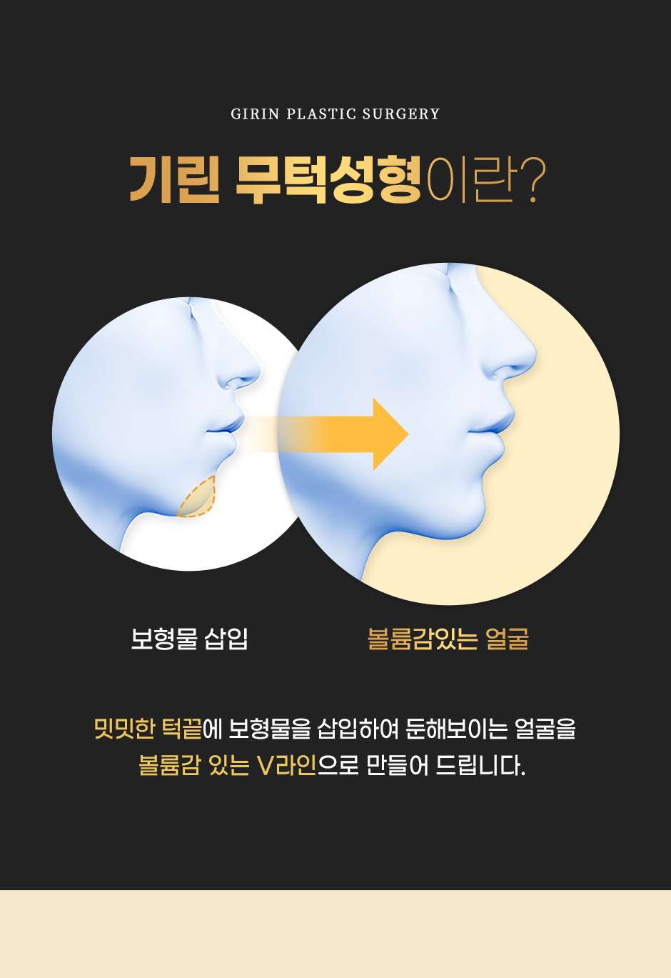 보형물윤곽성형_미인하이_05.jpg