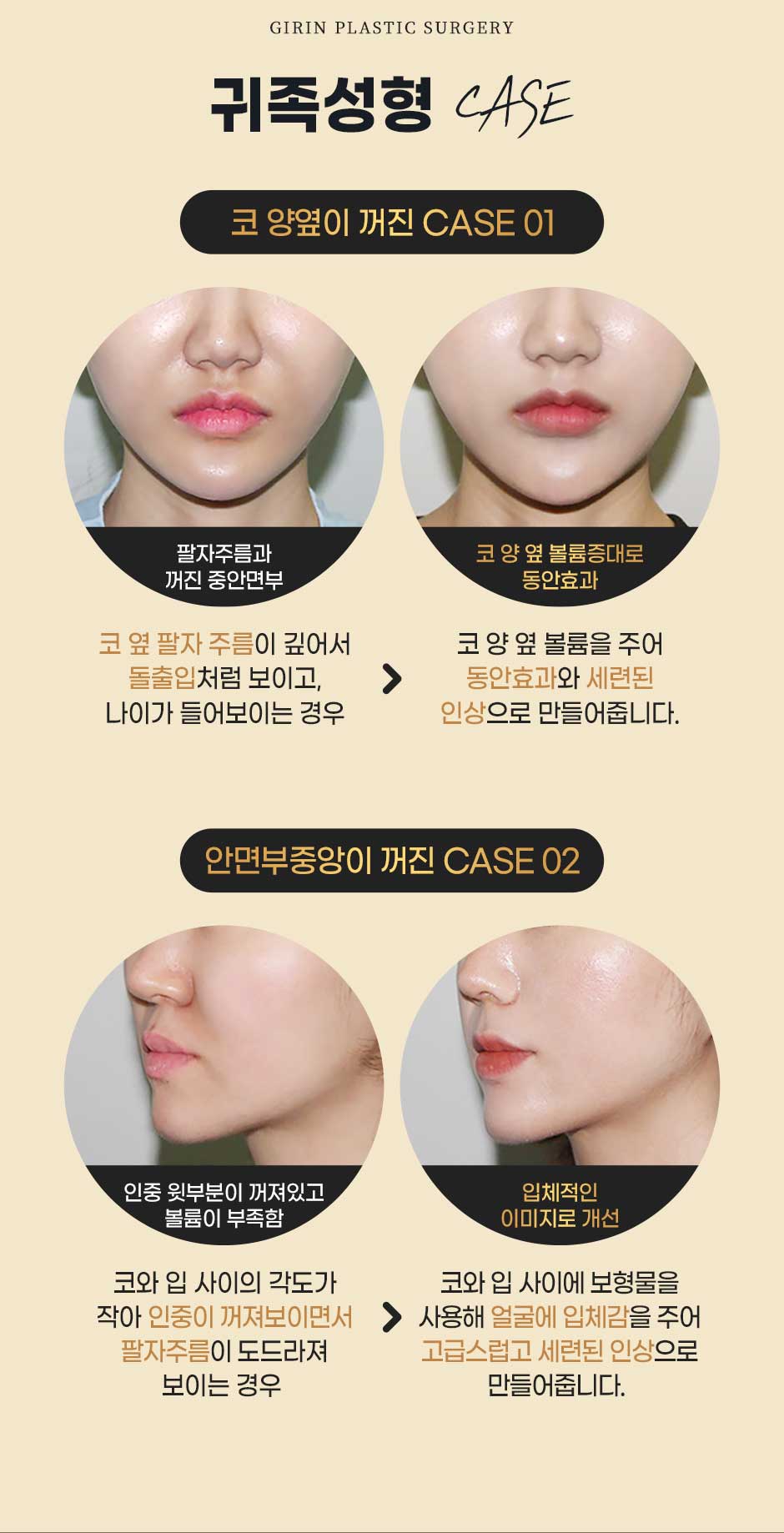 보형물윤곽성형_미인하이_04.jpg