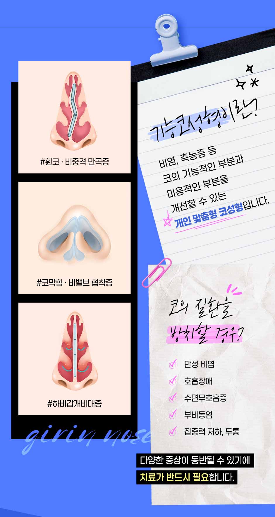 기능코성형_04.jpg