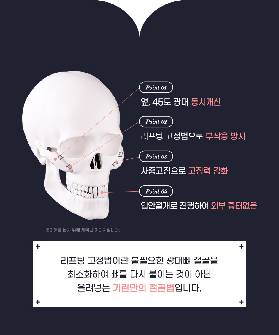 광대축소_03.jpg