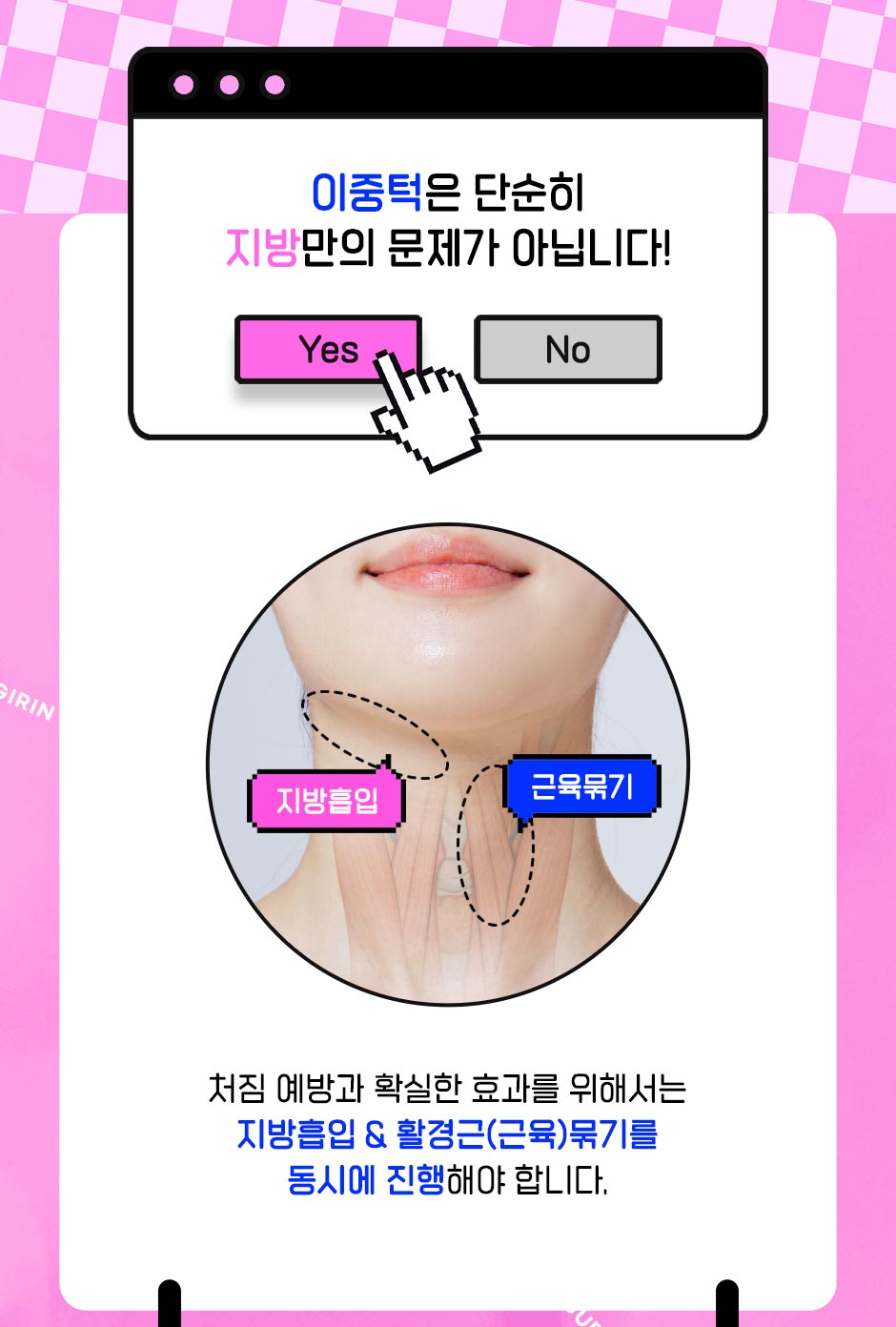 이중턱근육묶기&얼굴지흡_02.jpg