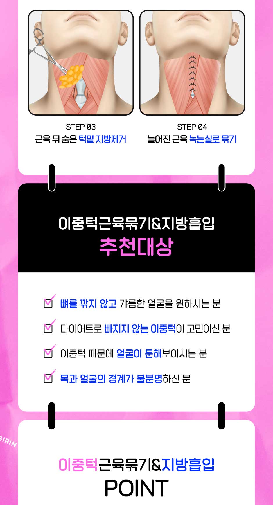 이중턱근육묶기&얼굴지흡_05.jpg