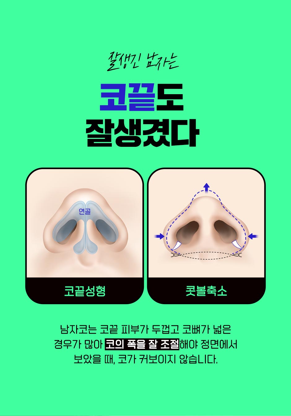 남자직선코성형_03.jpg