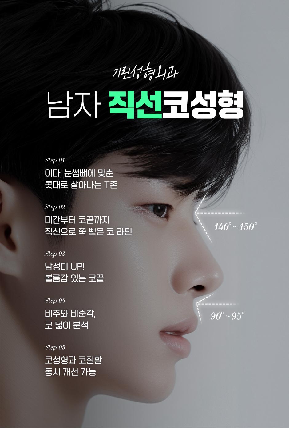 남자직선코성형_04.jpg