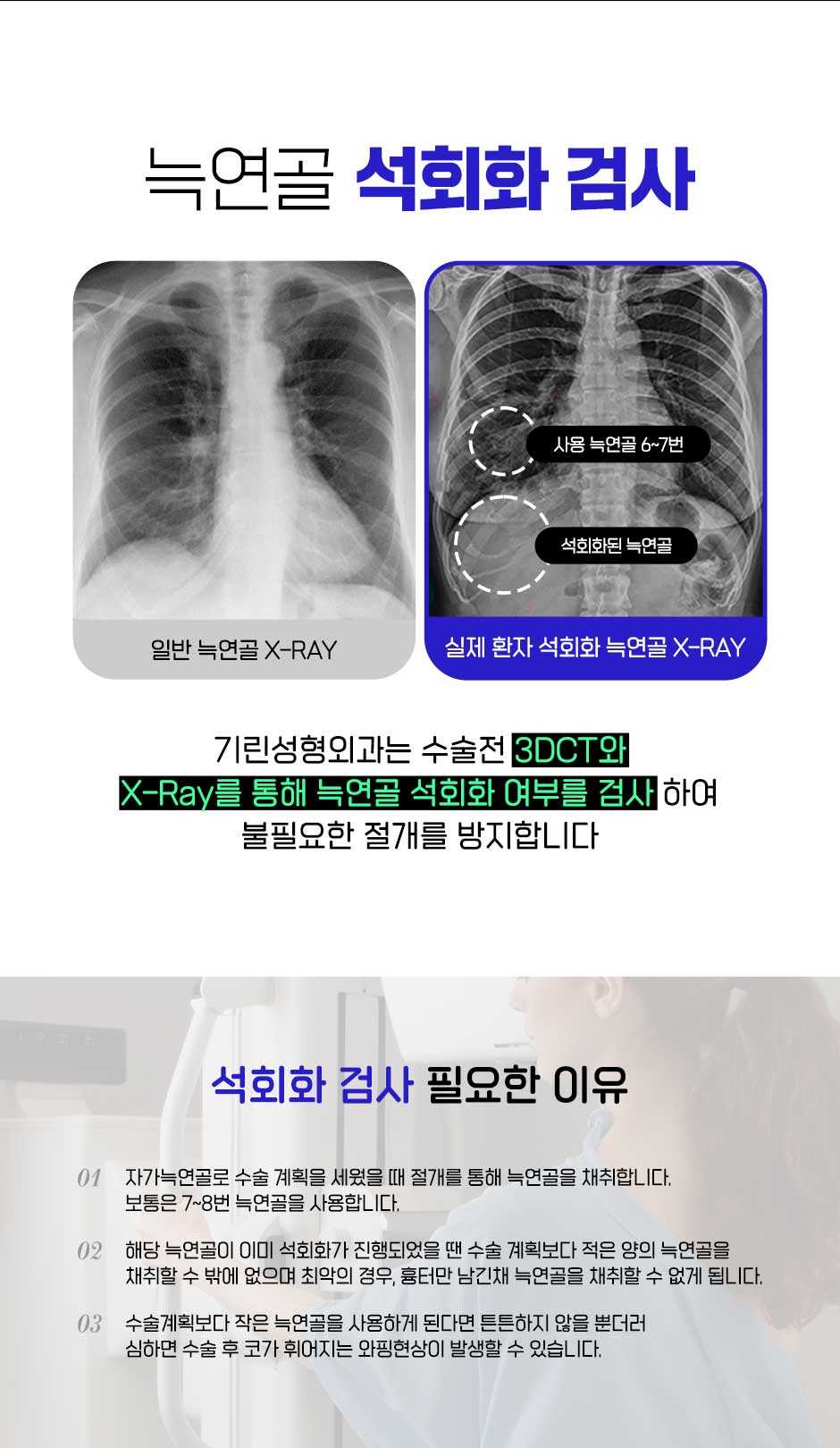남자직선코성형_08.jpg