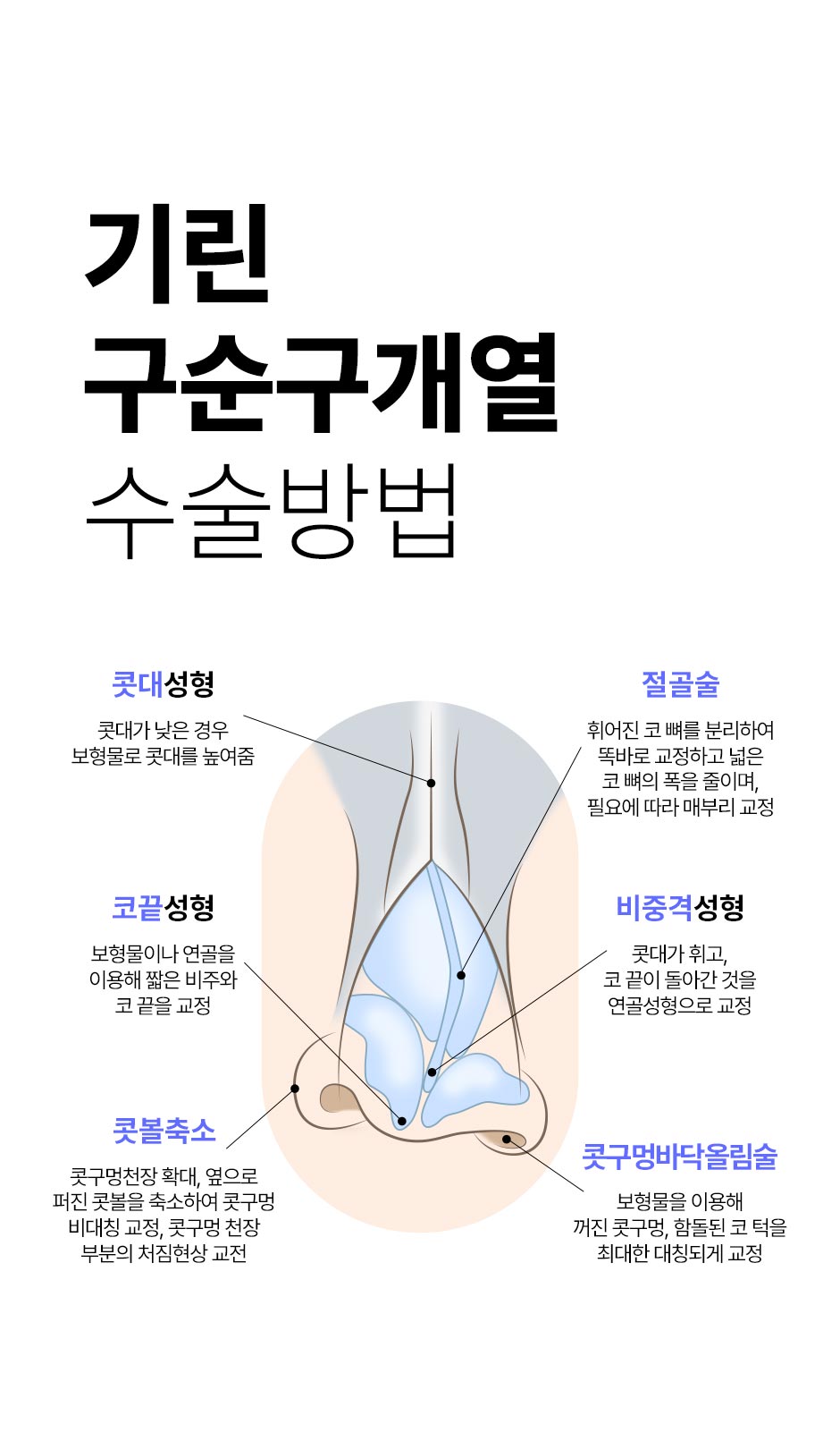 구순구개열코성형_05.jpg