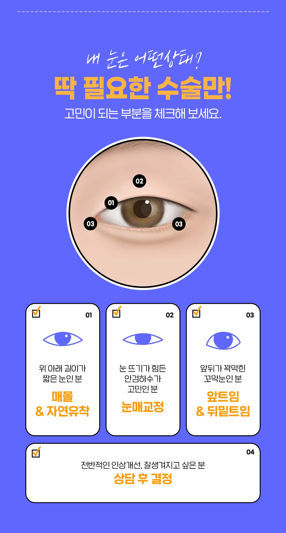 남자눈성형_09.jpg