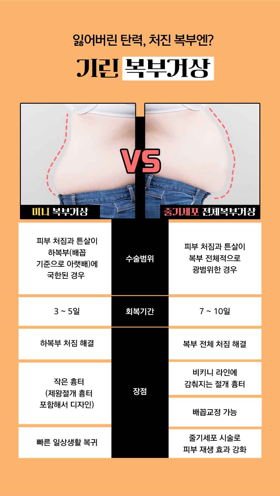 줄기세포복부거상_미인하이_06.jpg