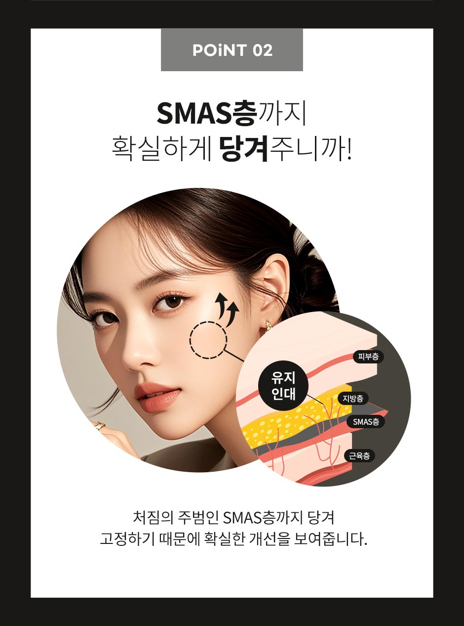 안면거상_06.jpg