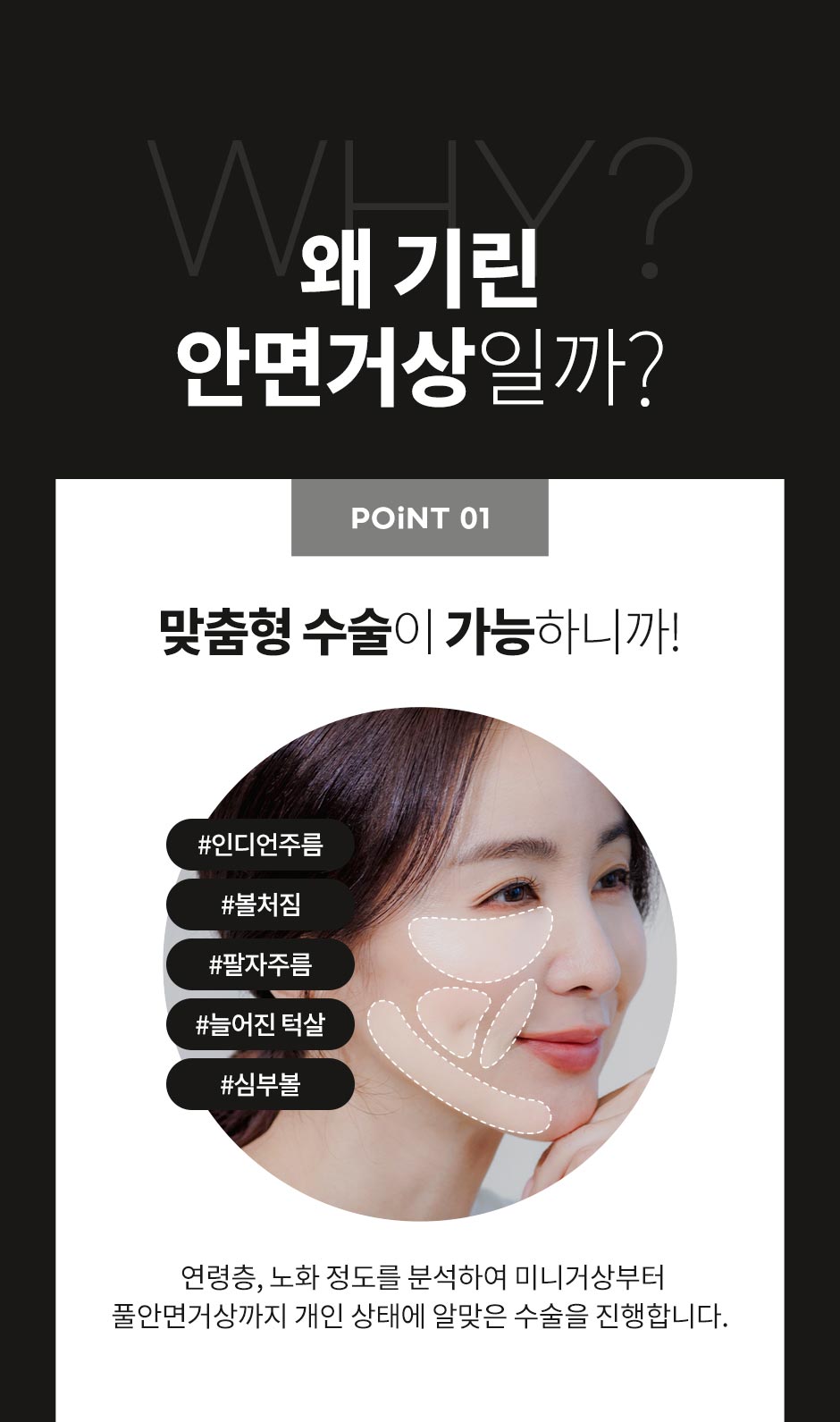 안면거상_05.jpg