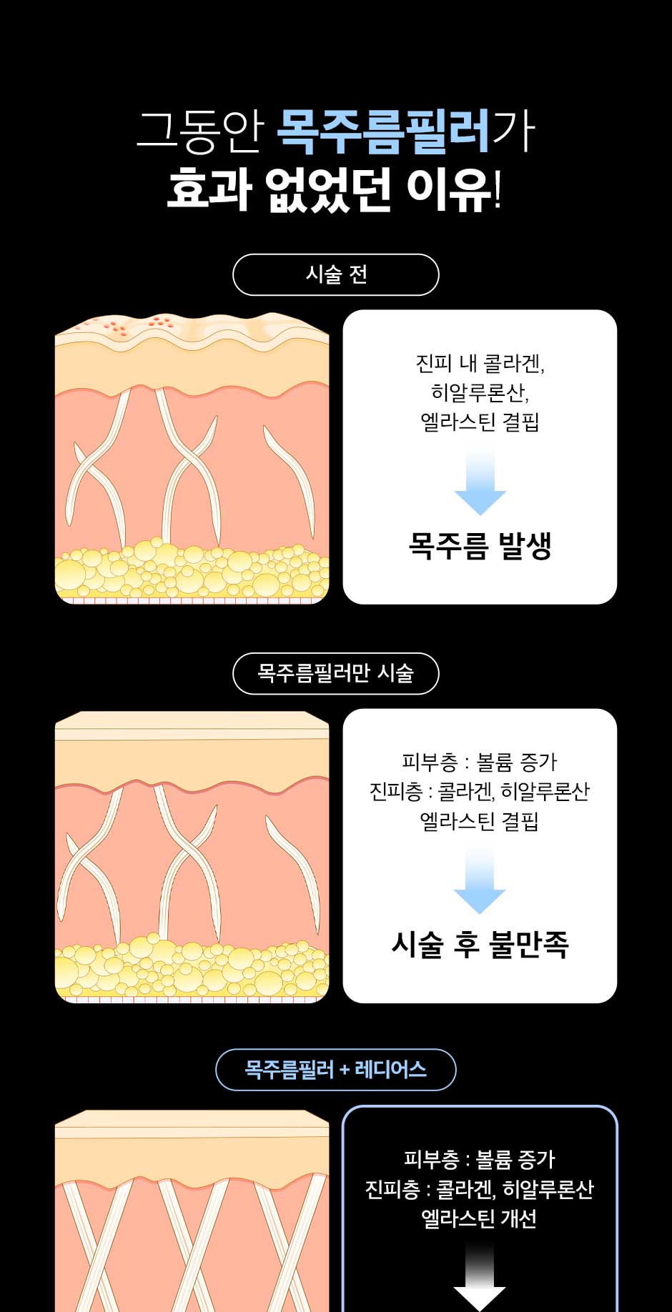 레디어스_04.jpg