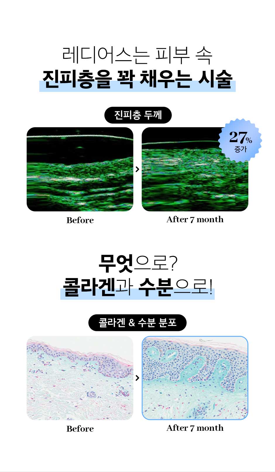 레디어스_03.jpg