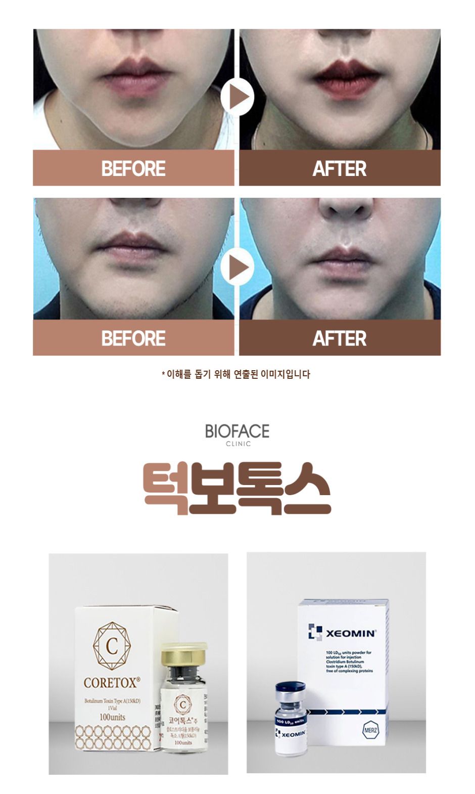 사각-턱보톡스-랜딩페이지-커팅3.jpg