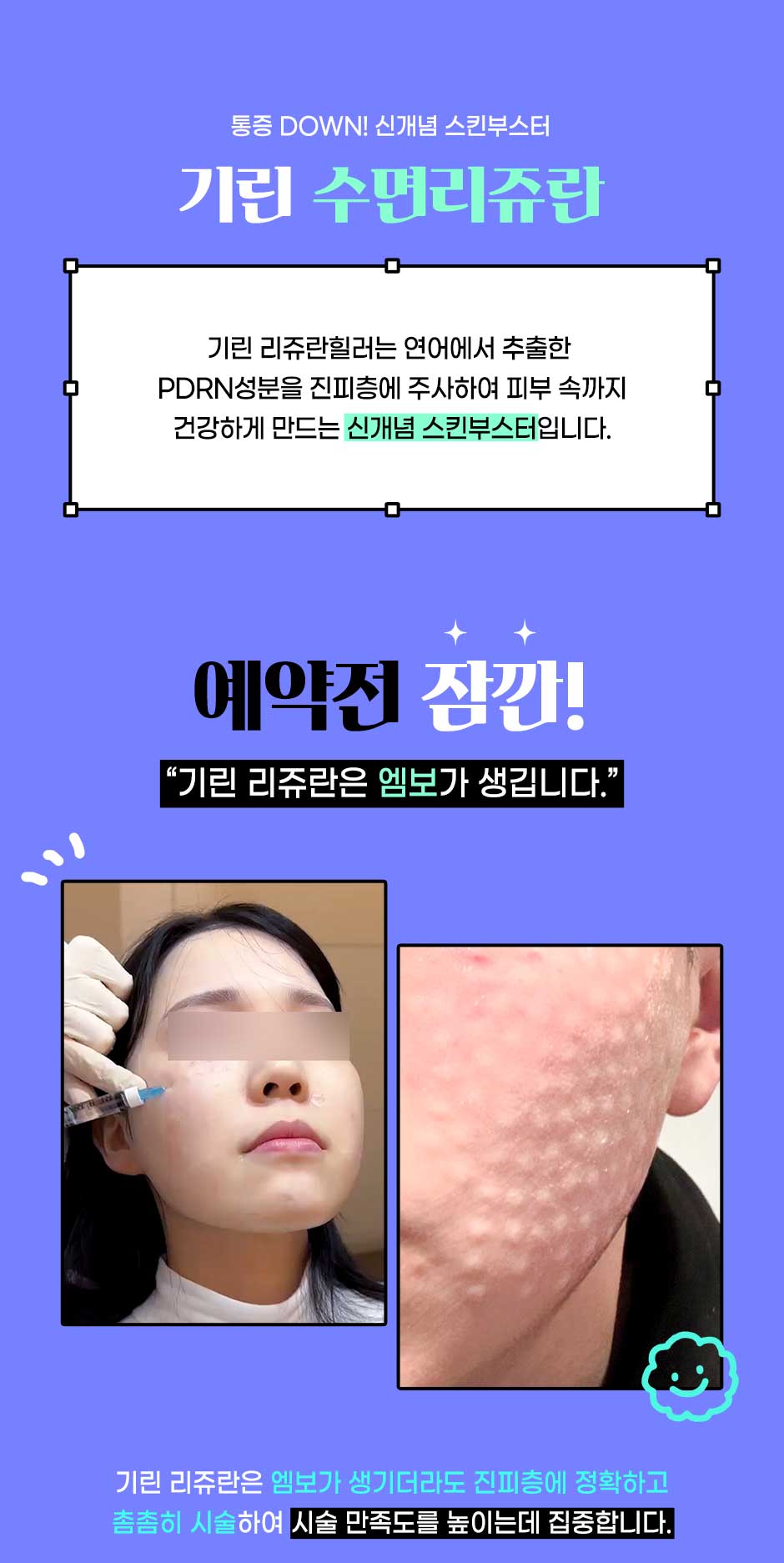 수면리쥬란_02.jpg