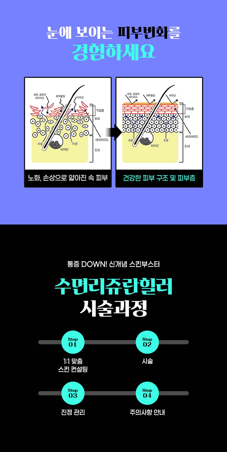수면리쥬란_07.jpg