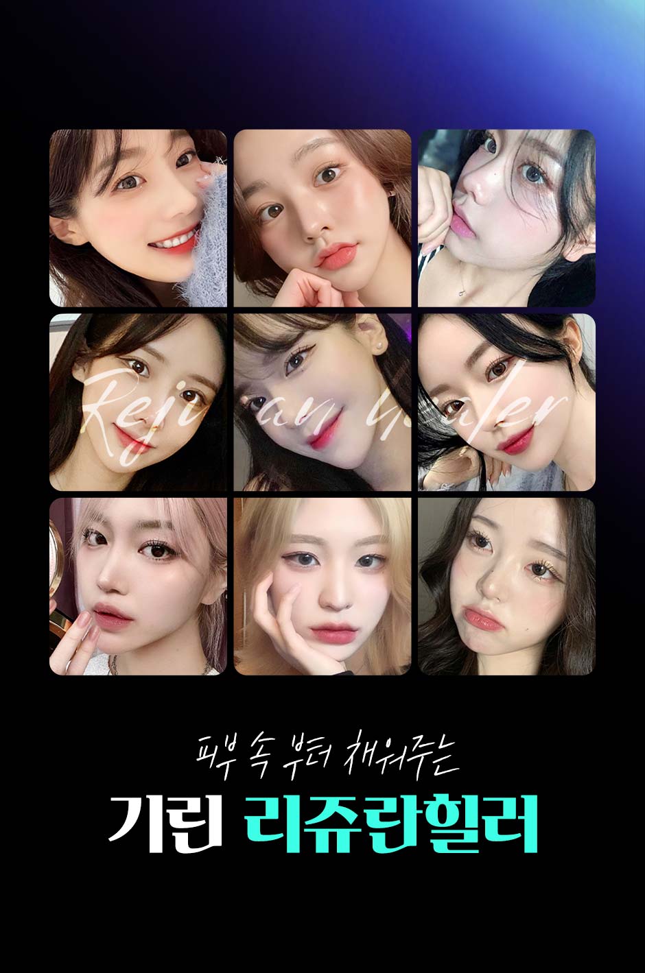 수면리쥬란_12.jpg
