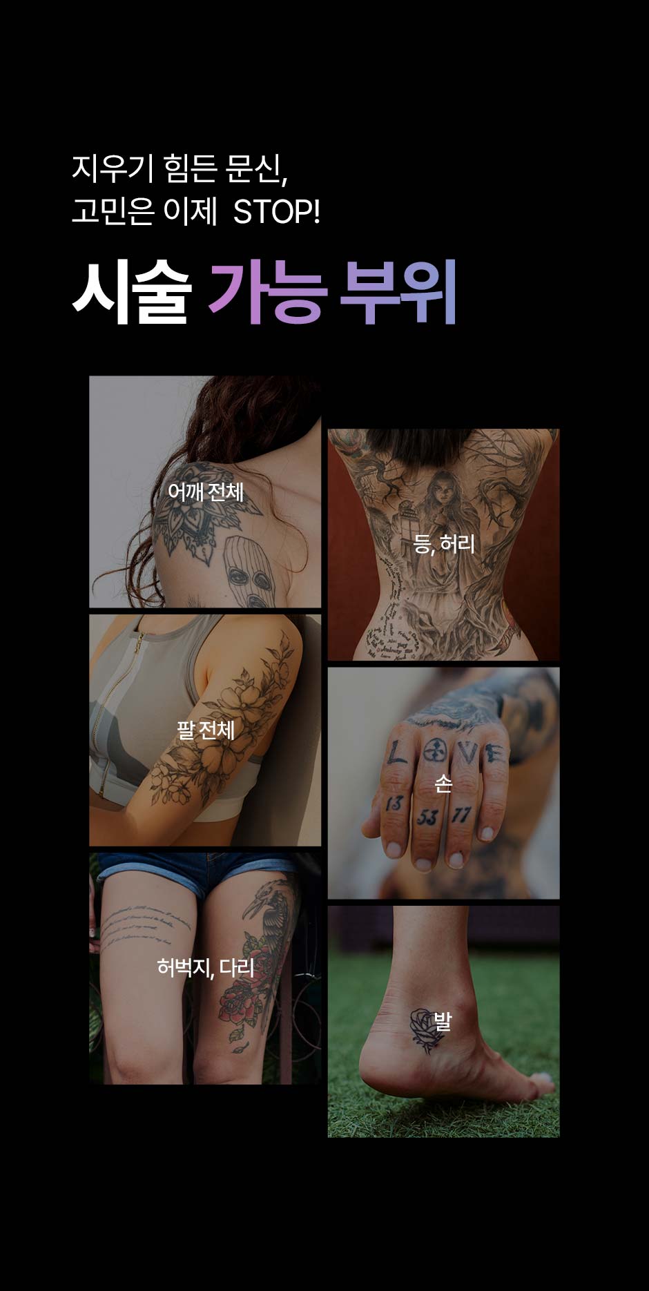 피코문신제거_09.jpg