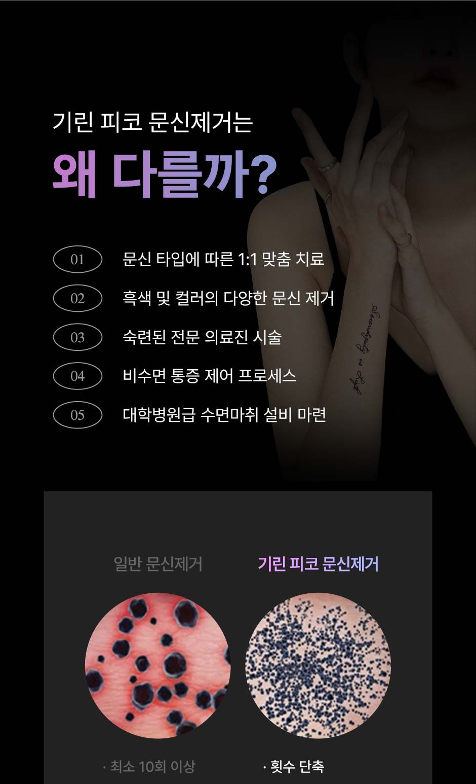 피코문신제거_07.jpg