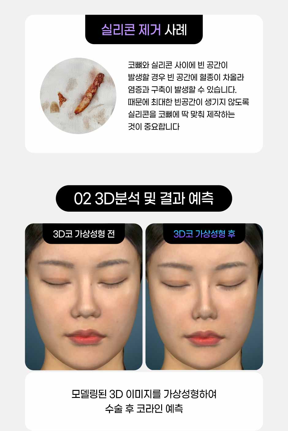 프리미엄보형물코성형_07.jpg