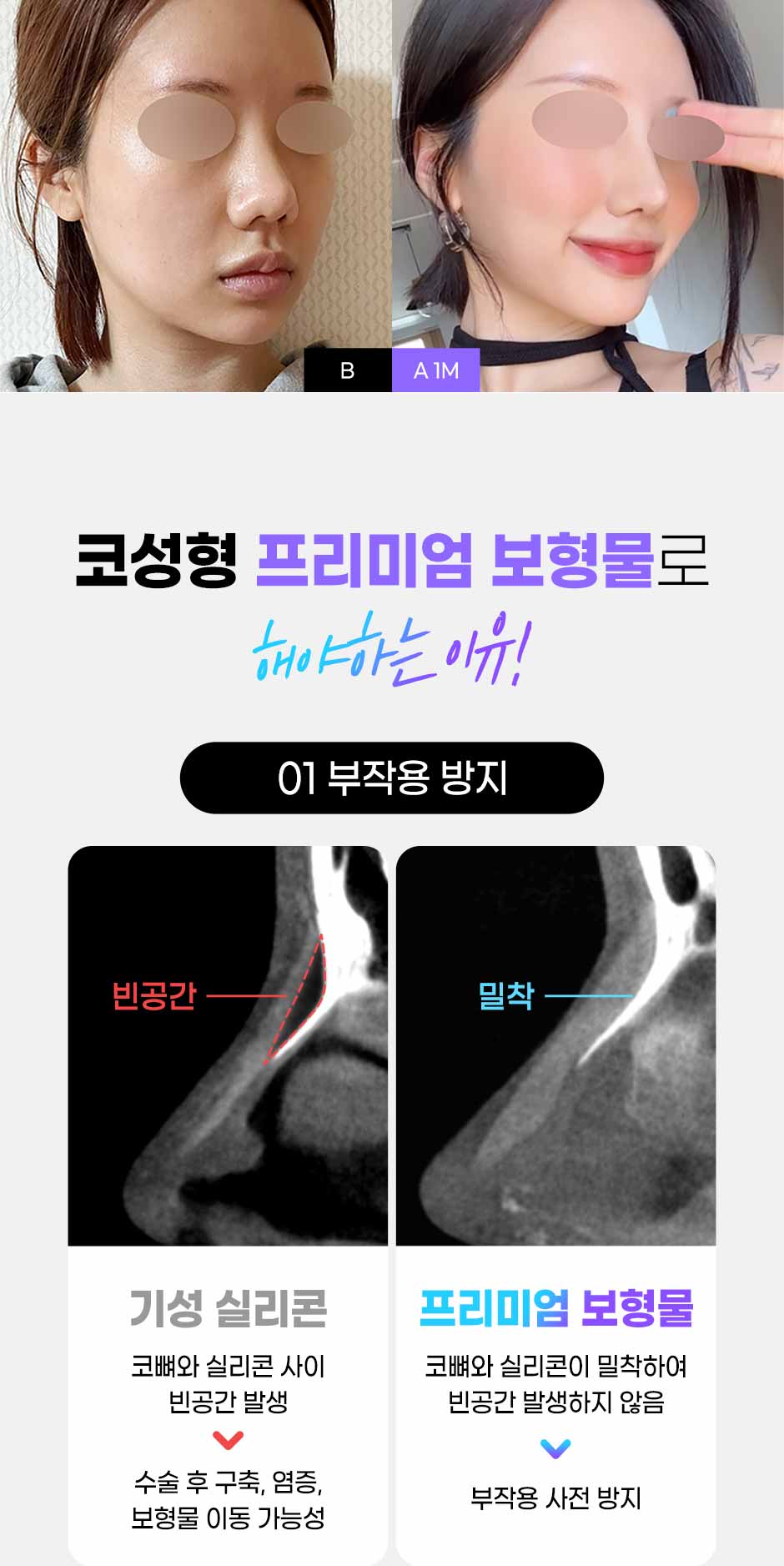 프리미엄보형물코성형_06.jpg