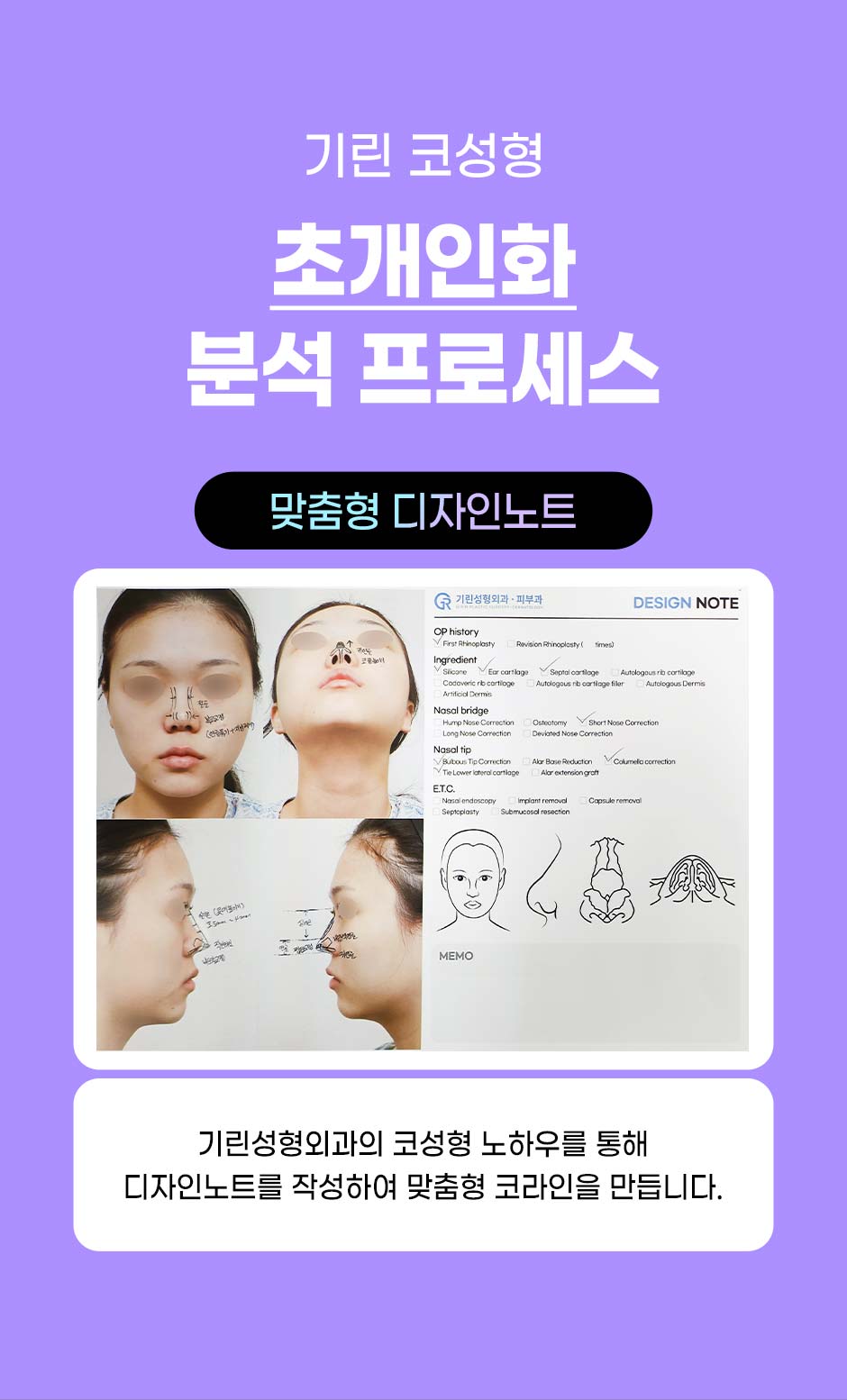 프리미엄보형물코성형_09.jpg