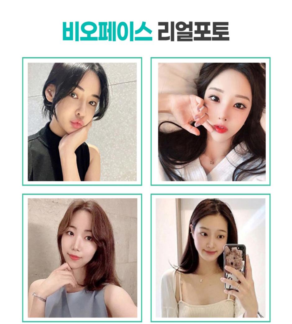 턱_crop5.jpg