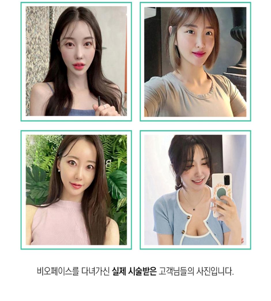 턱_crop6.jpg