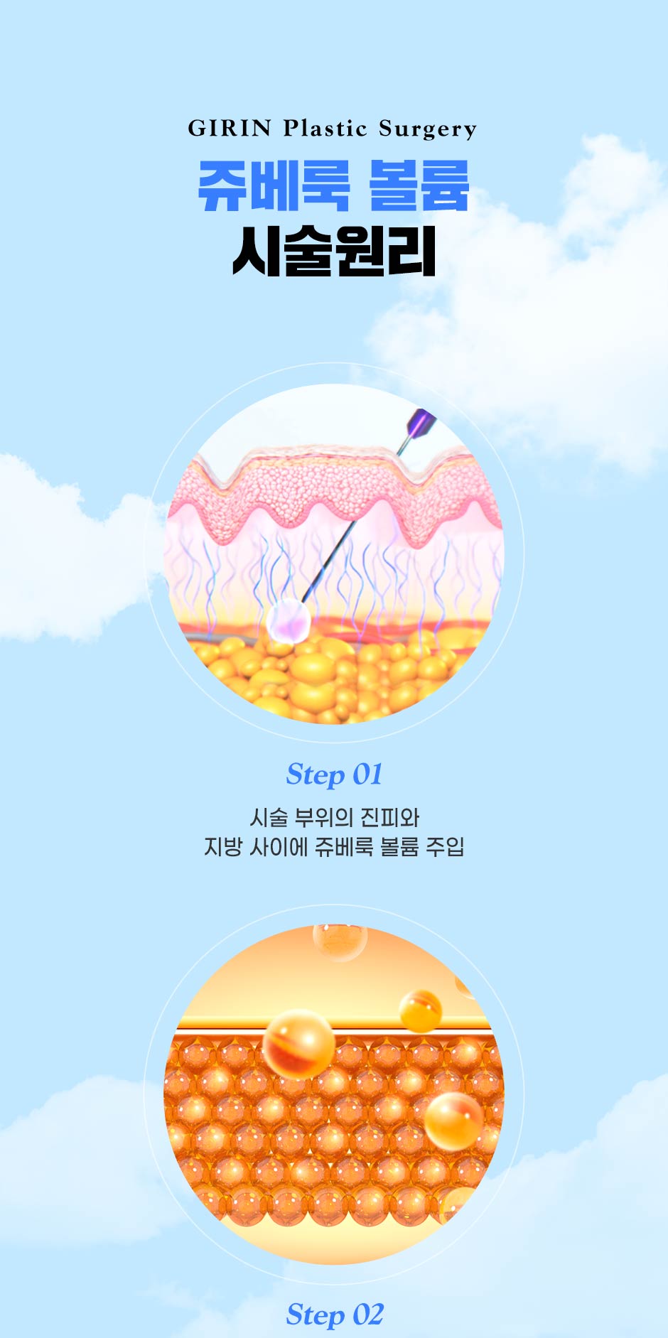 수면쥬베룩볼륨_미인하이_05.jpg