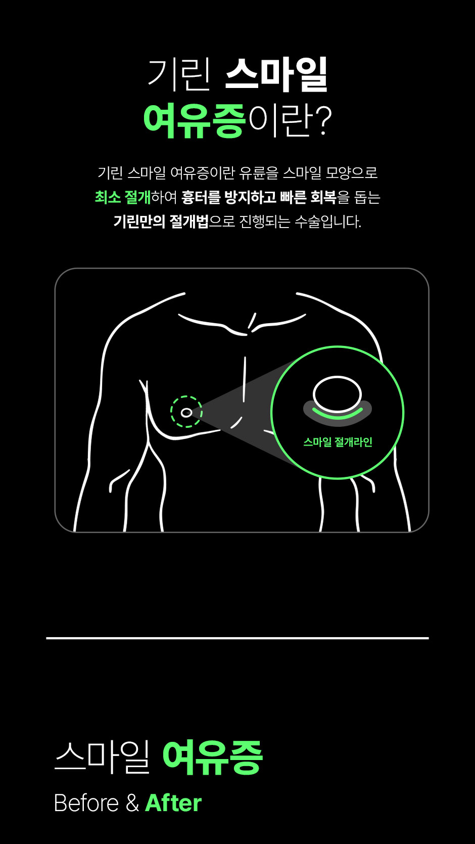 스마일여유증_02.jpg
