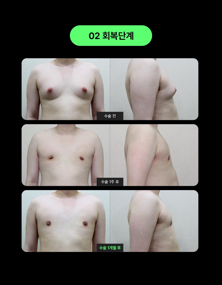 스마일여유증_08.jpg