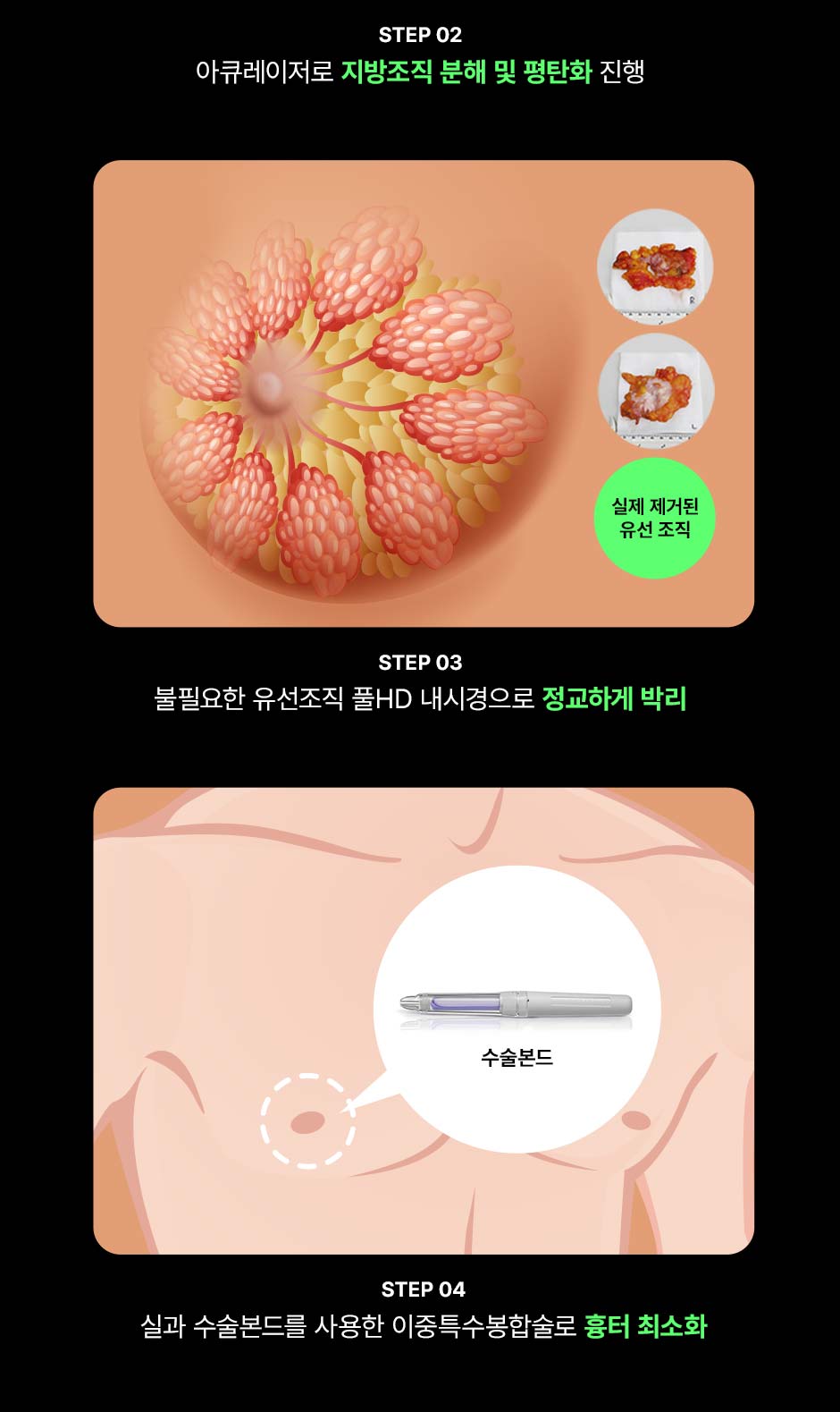 스마일여유증_07.jpg