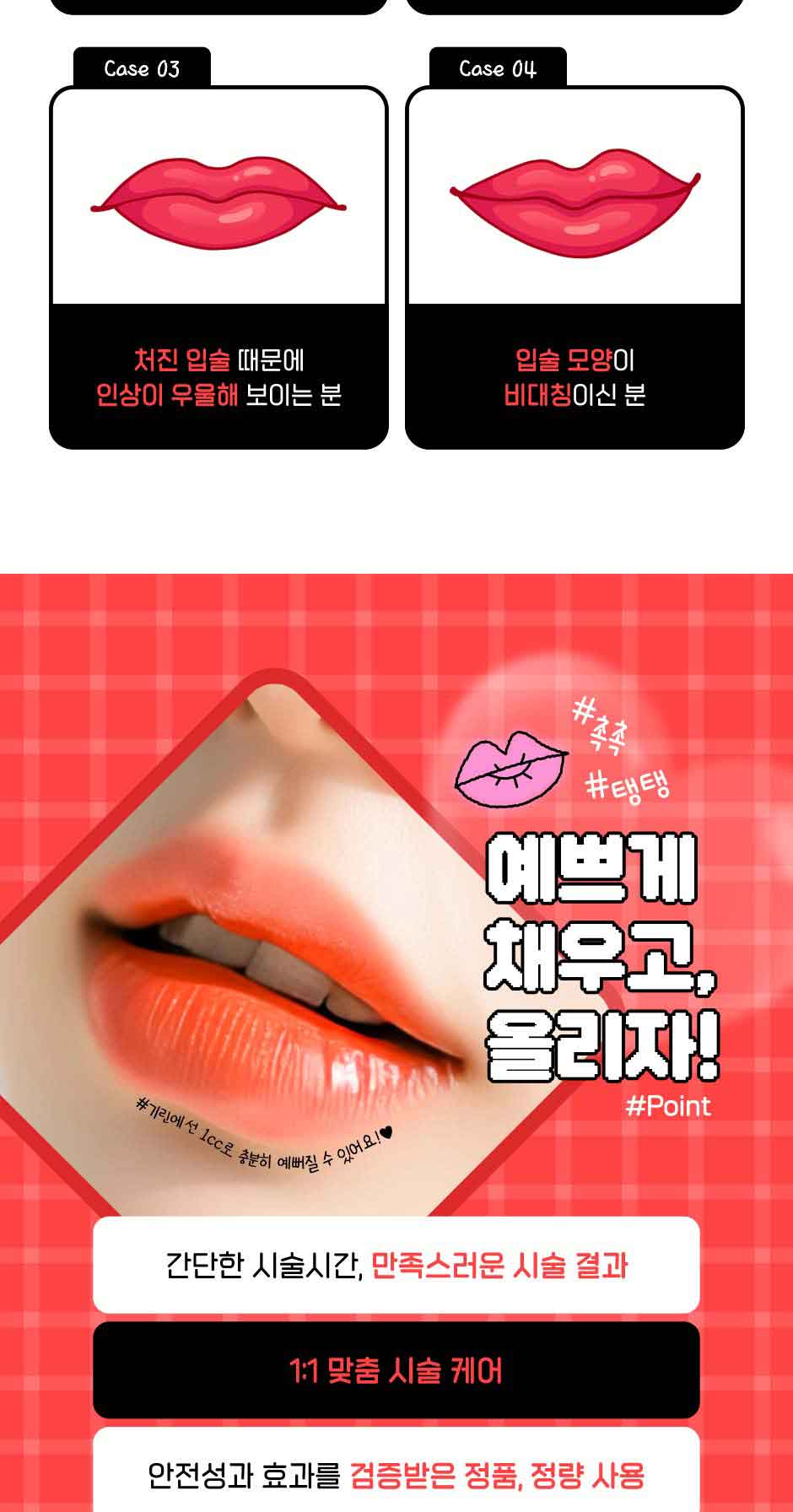 입꼬리입술필러_미인하이_06.jpg