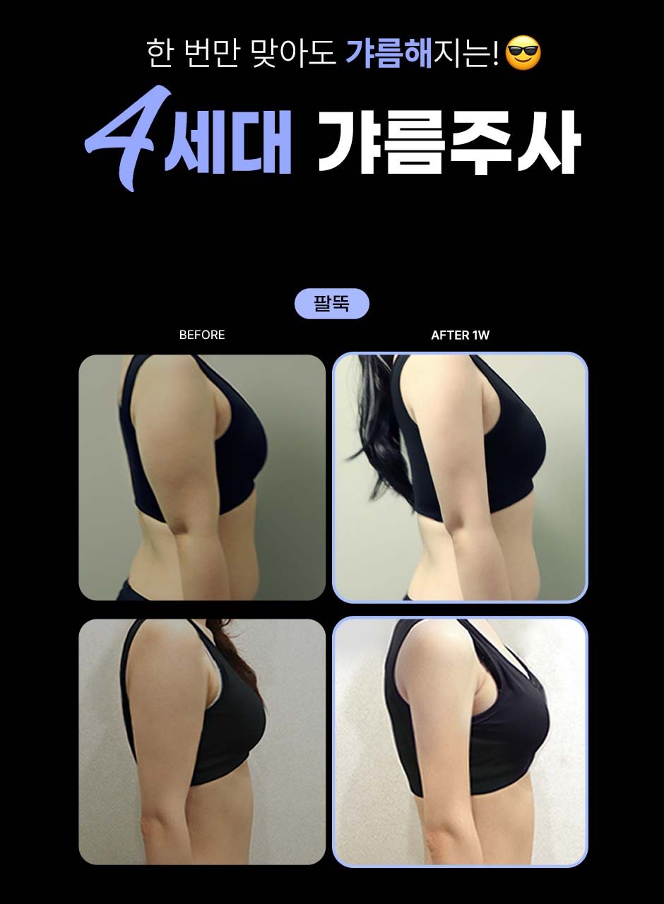 바디갸름주사_미인하이_06.jpg