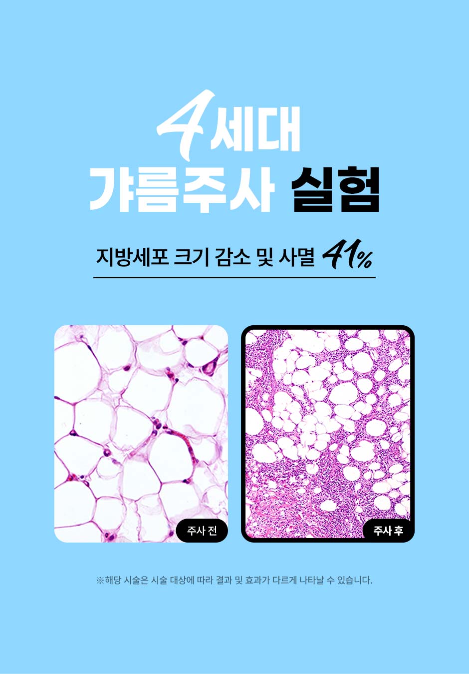 얼굴갸름주사_04.jpg