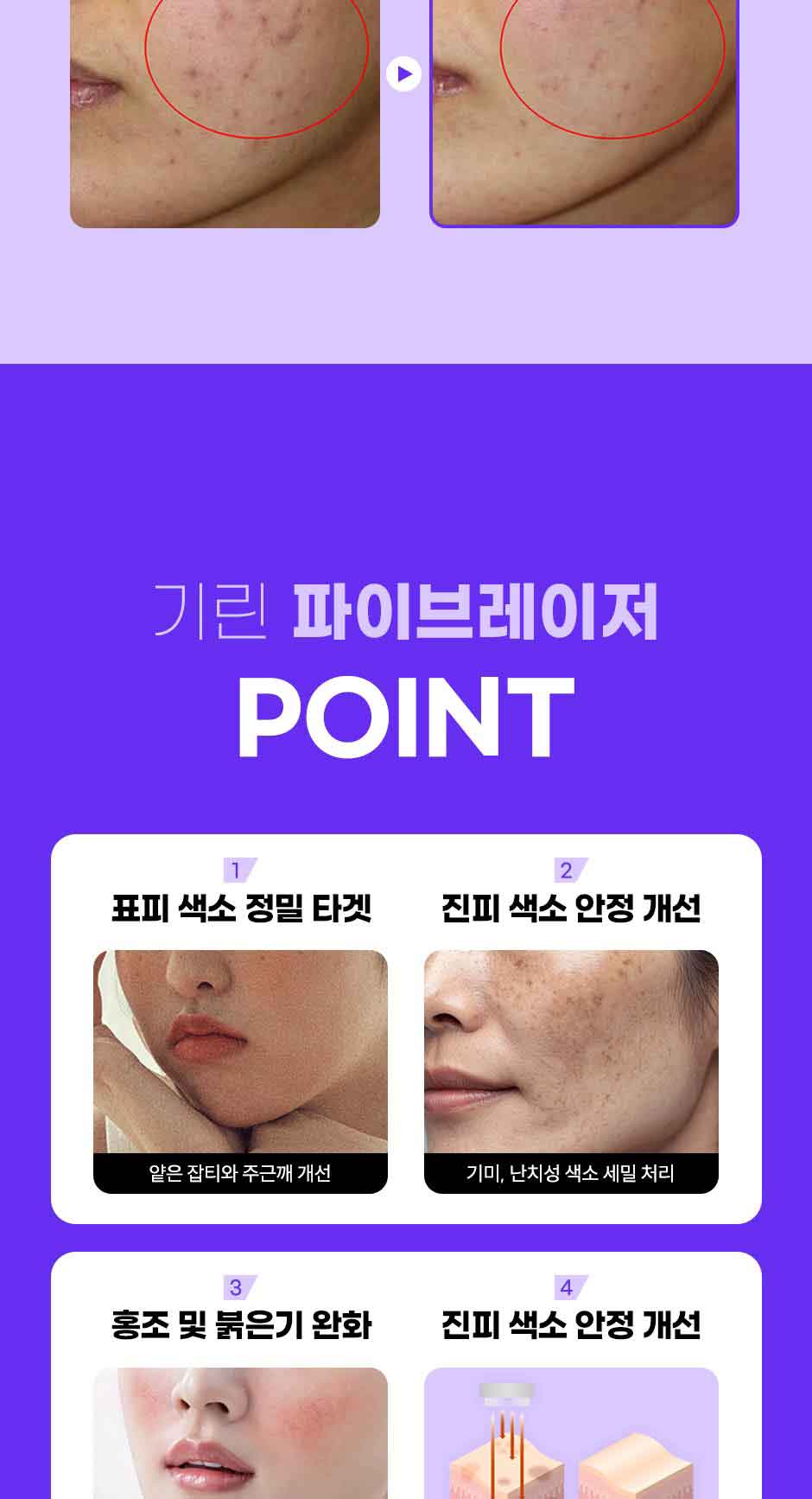 파이브레이저_미인하이_04.jpg