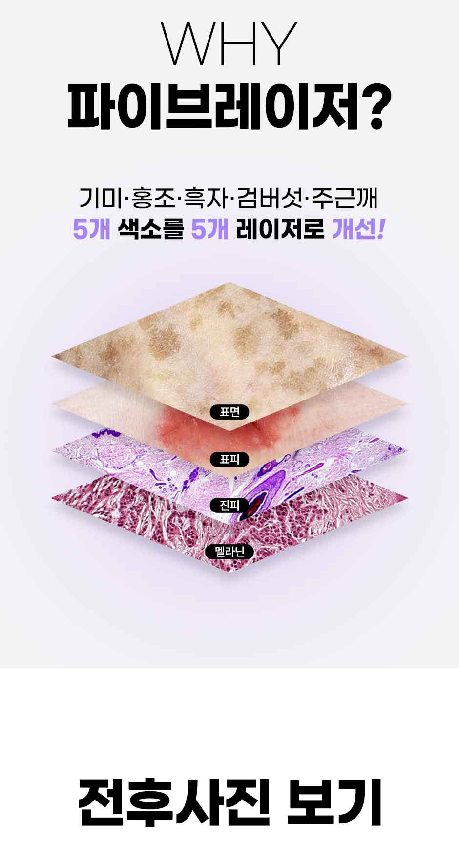 파이브레이저_미인하이_02.jpg