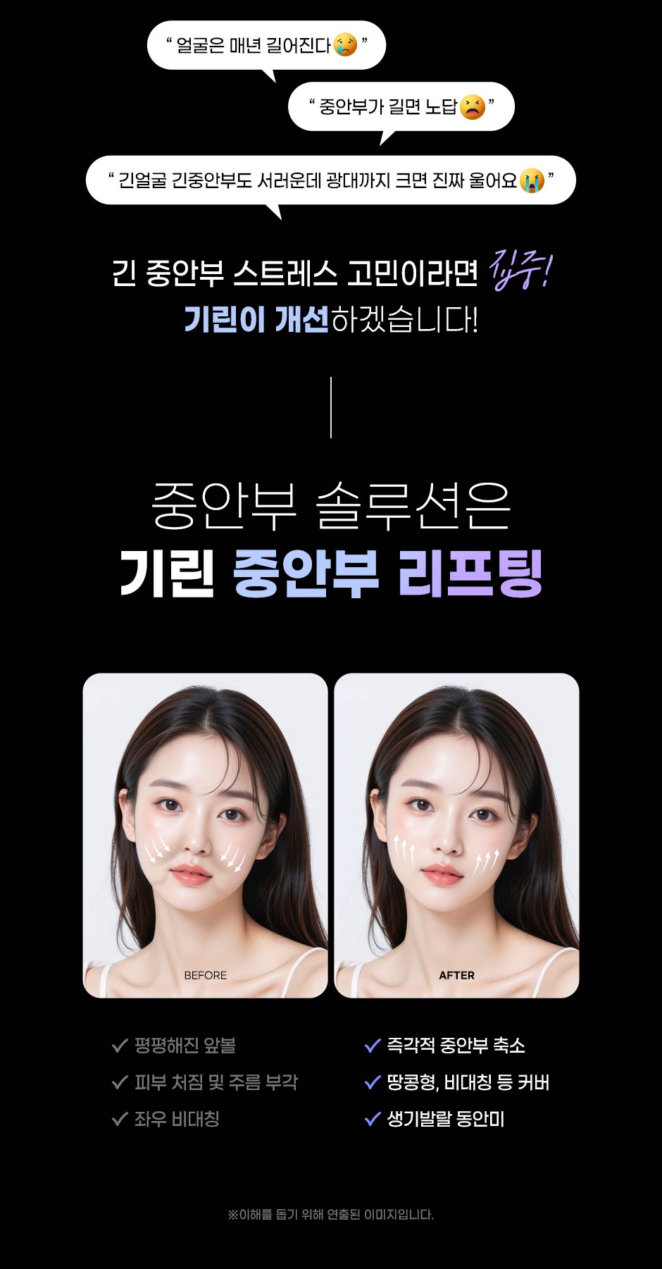 중안부리프팅_미인하이_02.jpg