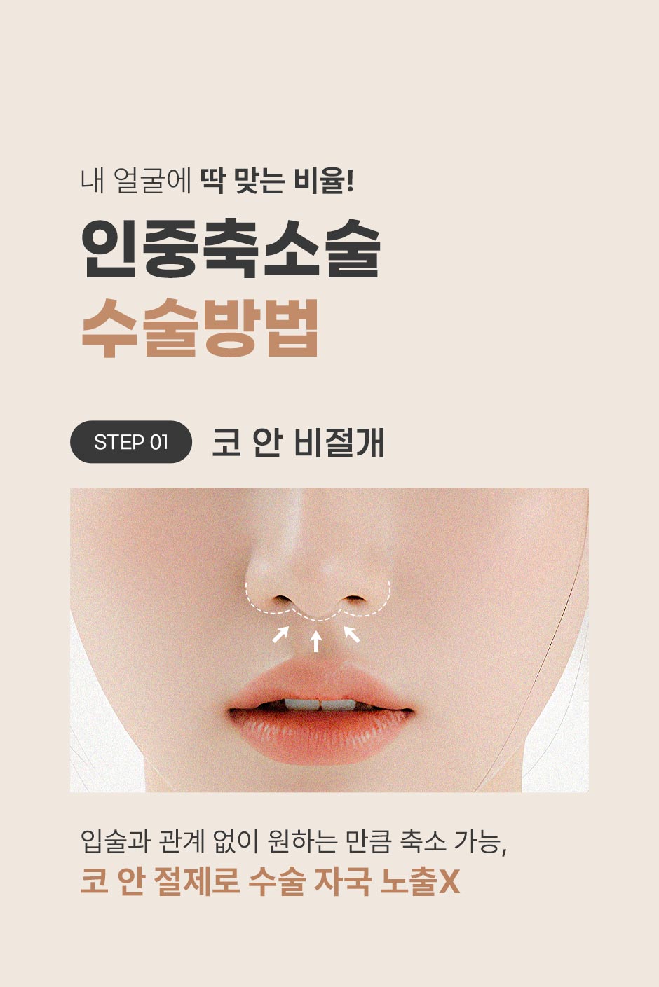 인중성형_05.jpg