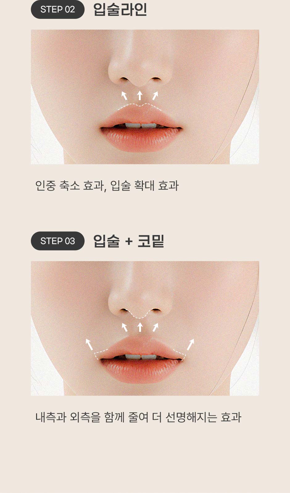 인중성형_06.jpg