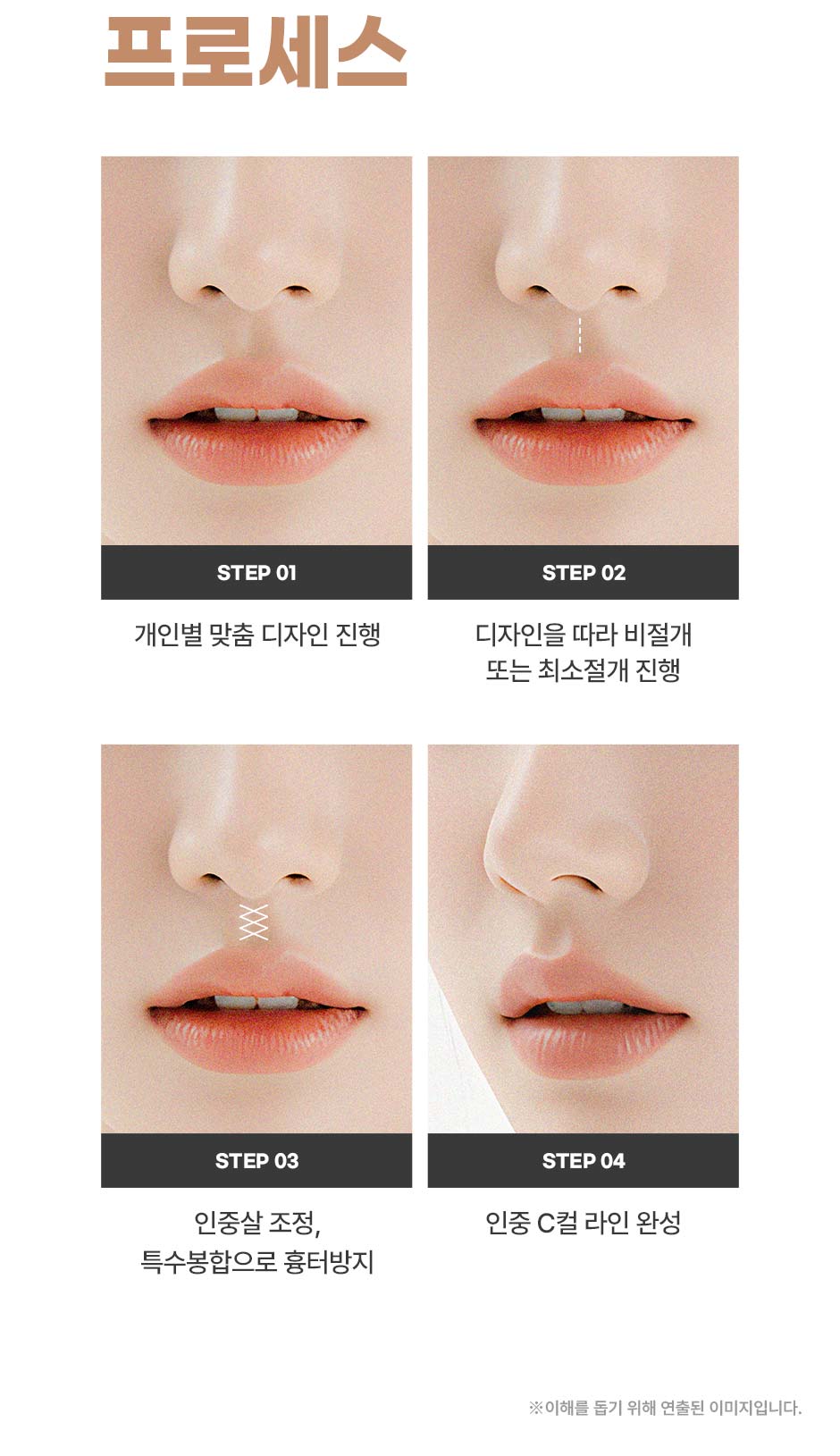 인중성형_08.jpg