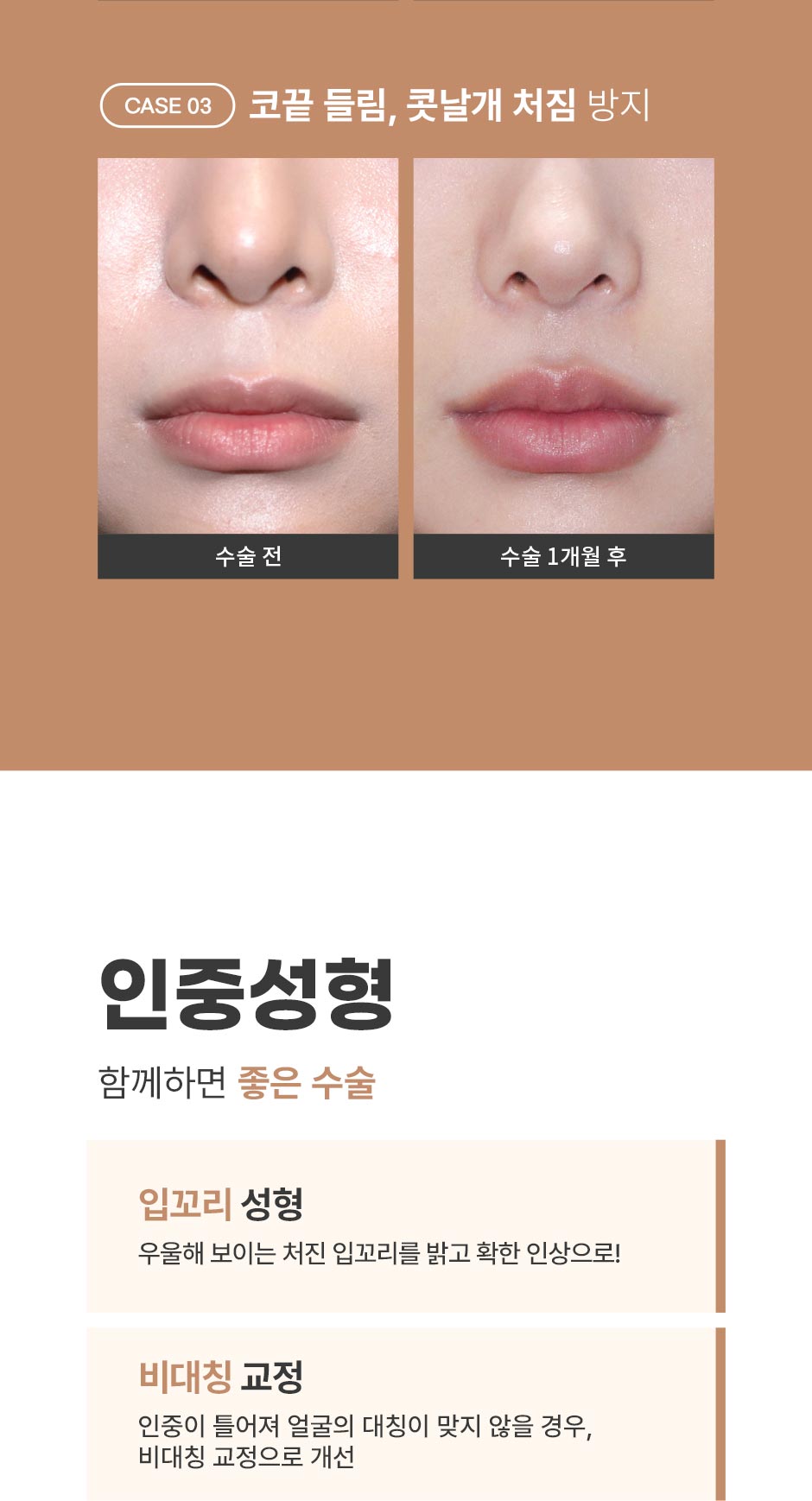 인중성형_10.jpg