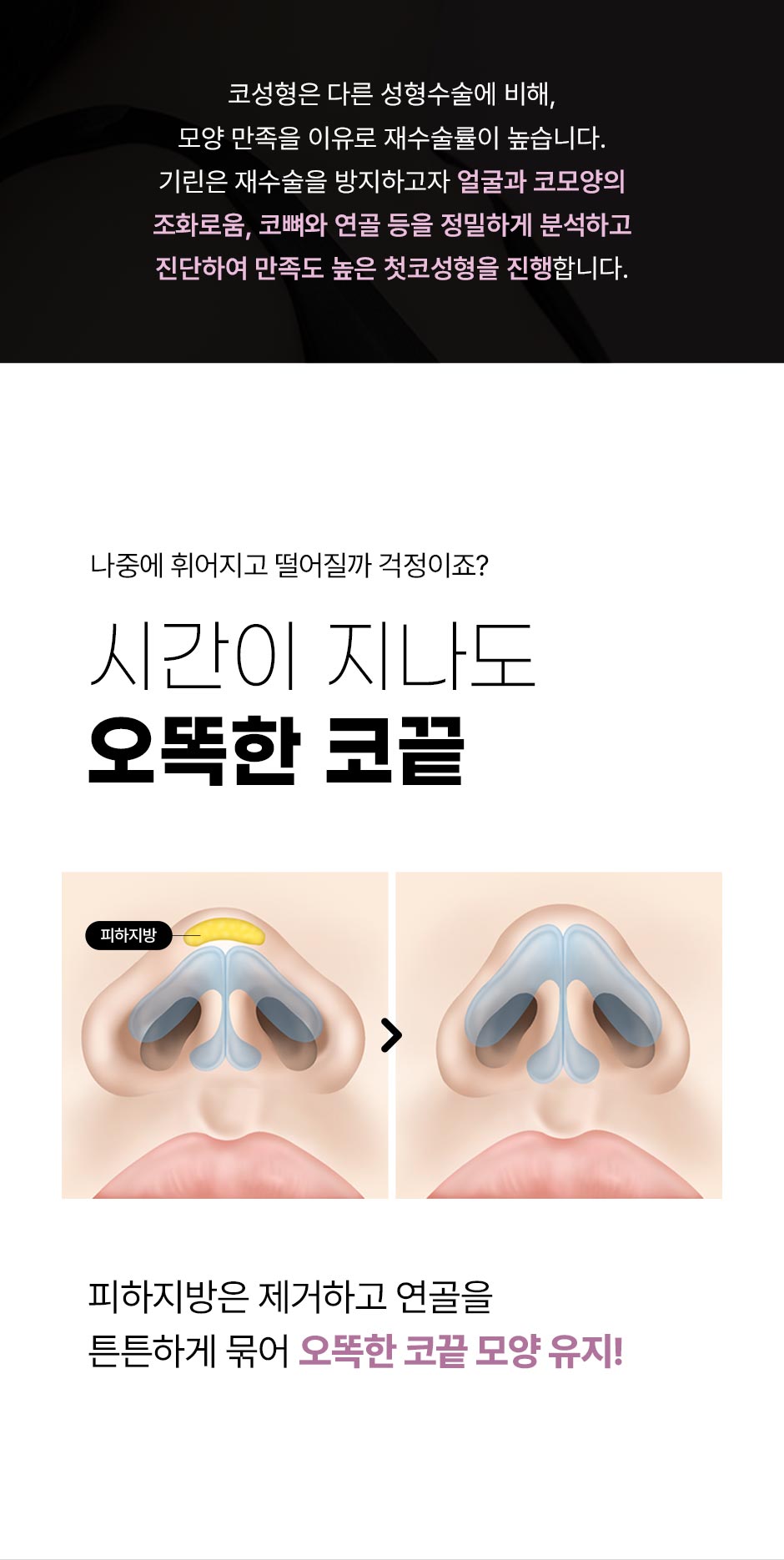 첫코성형_08.jpg