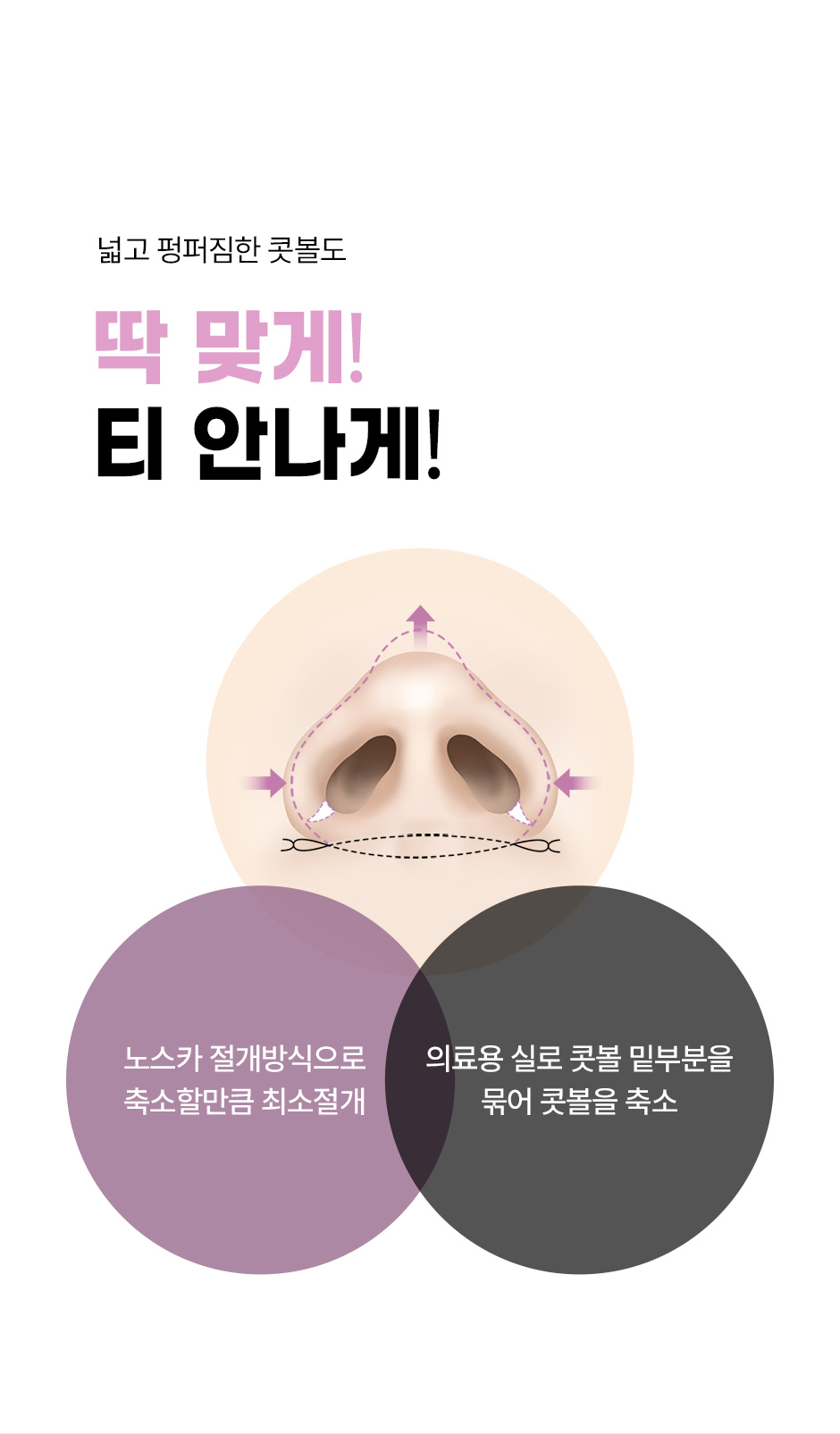 첫코성형_10.jpg