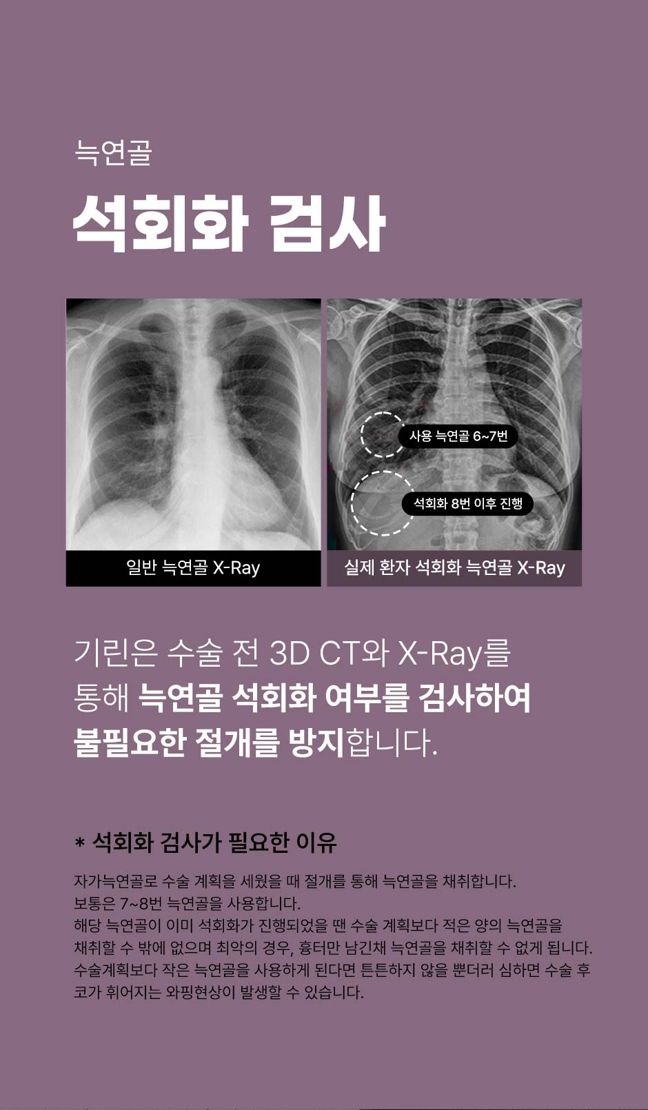 첫코성형_12.jpg