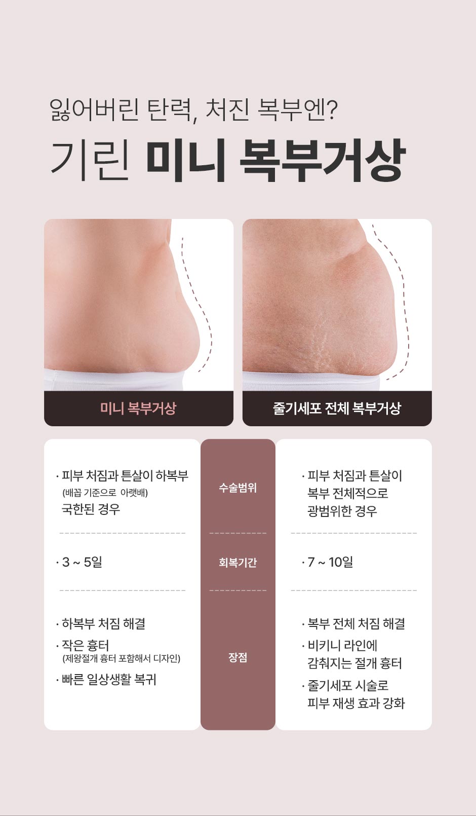 미니복부거상_미인하이_05.jpg