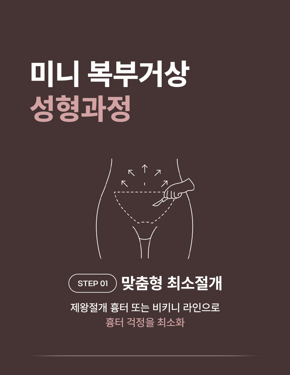 미니복부거상_미인하이_06.jpg