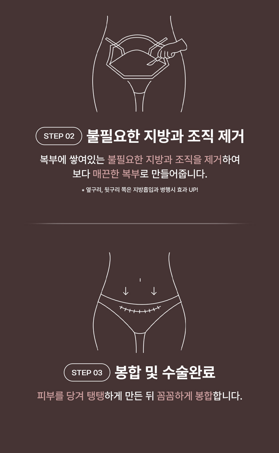 미니복부거상_미인하이_07.jpg